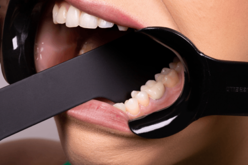 C Shape Retractors for Occlusion Black Photography - Image 3