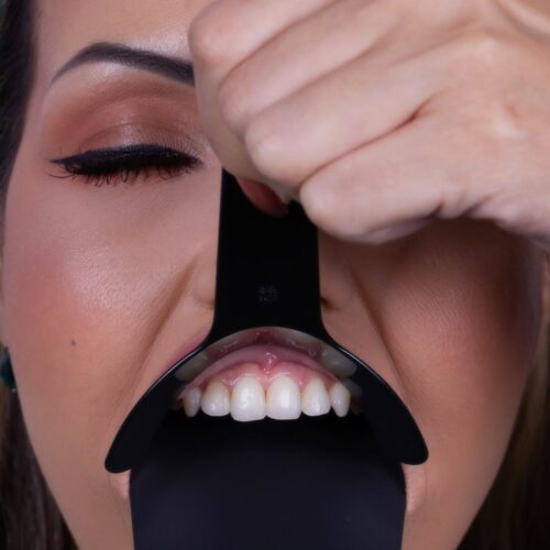 Indusbello Lip Retractor Model MF - Image 2