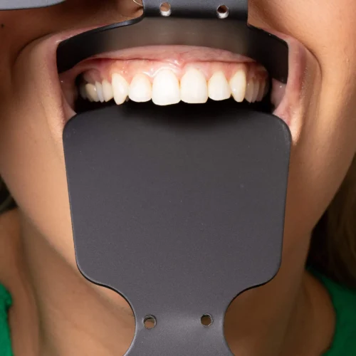 Indusbello Contraster for Dental Photography-Occlusal Adult - Image 3