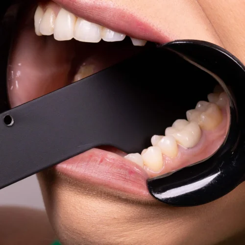 Indusbello Contraster for Dental Photography-08 - Image 2