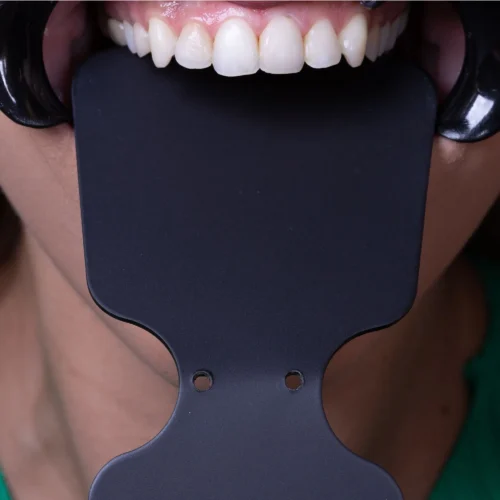 Indusbello Contraster for Dental Photography-07 - Image 2