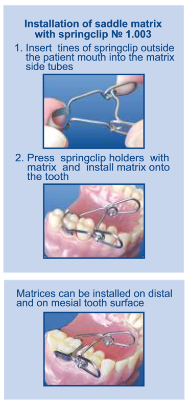 SADDLE MATRIX SYSTEM KIT WITH SPRINGCLIP - Image 2